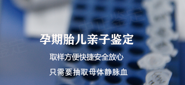 南充怀孕如何办理DNA亲子鉴定,南充办理怀孕亲子鉴定办理的条件