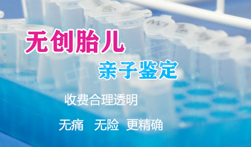 南充孕期如何偷偷做血缘检测,南充孕期亲子鉴定哪里做的准
